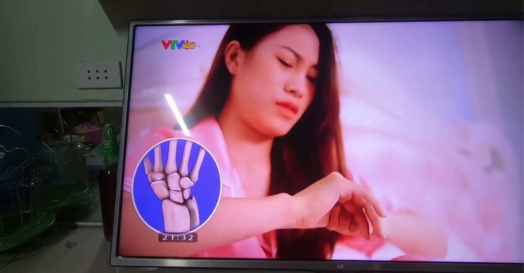 Phải làm gì khi tivi LG bị sọc ngang màn hình